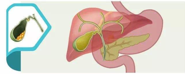 不吃早餐,更易被胆结石找上门,这是为啥呢?_胆汁