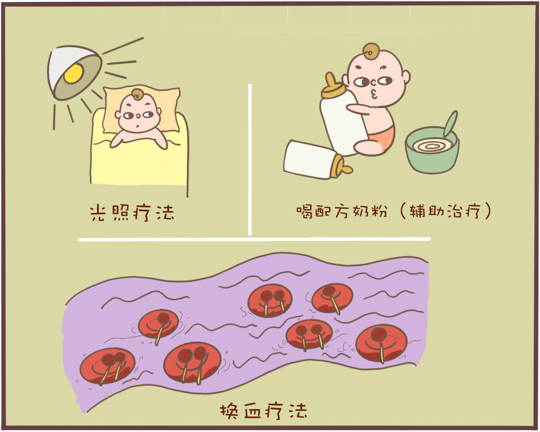 曬太陽就能去黃疸快速祛除新生兒黃疸的方法瞭解一下