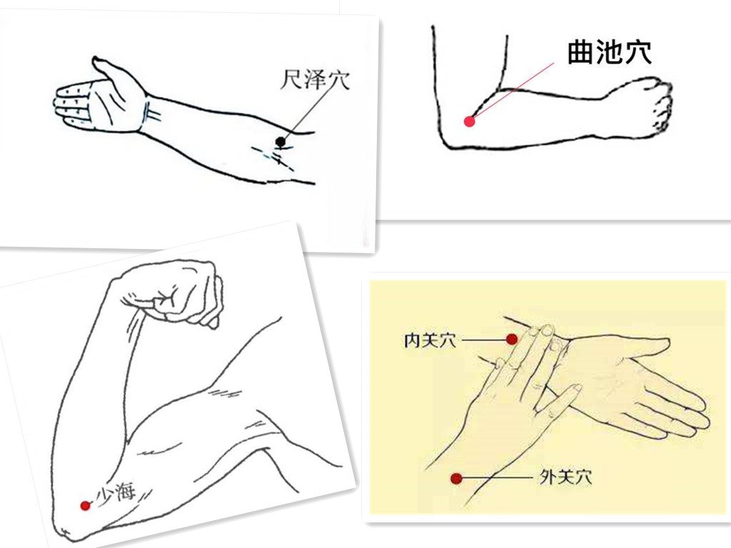 膝肘位图片