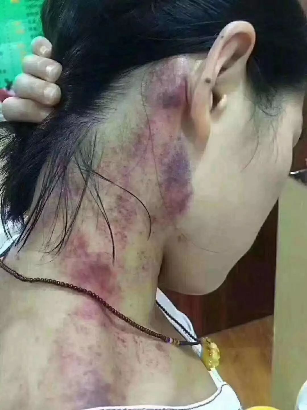 疏通肩颈经络和淋巴,调理颈椎.