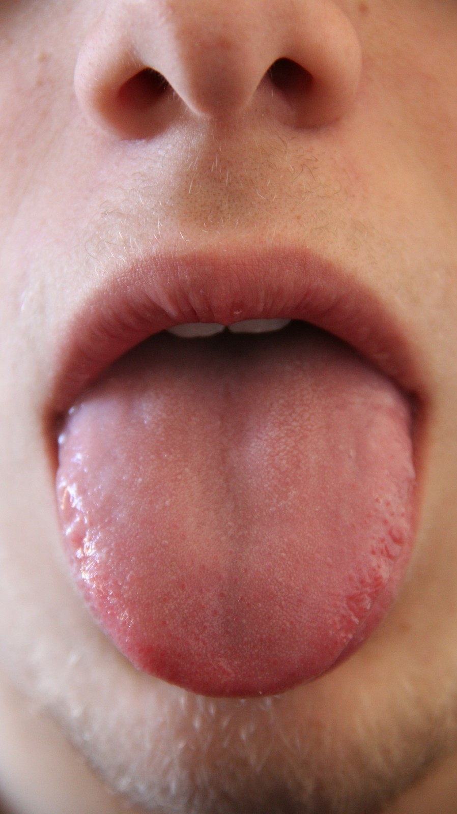 不论男女,一旦舌头出现3个异常,多半心脏不好,趁早就医