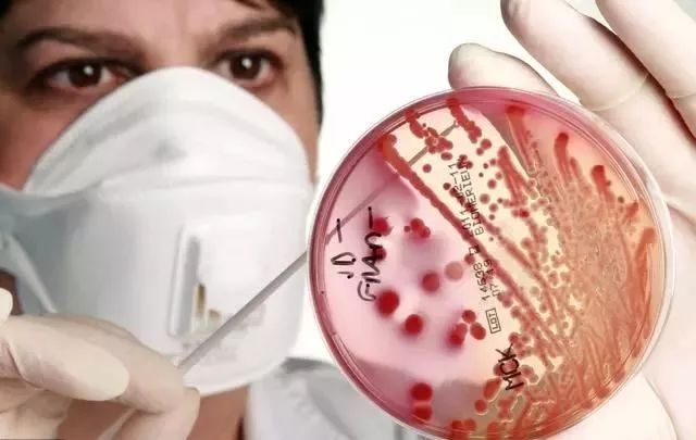 医用外科口罩与医用口罩有什么区别 46c7682e57d3457b98b1abd27eac4d01.jpeg