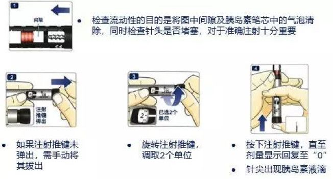 注射泵使用图图解图片