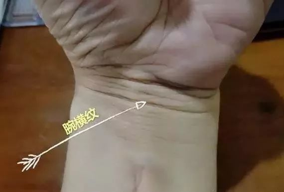 正确定位腕横纹很重要.前臂的很多穴位的定位都基于此线.