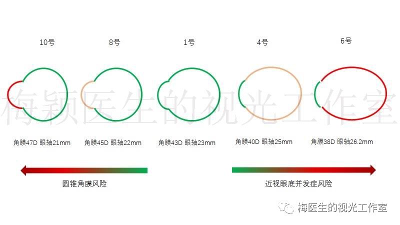 醫生請問孩子近視200度帶150度散光能戴角膜塑形嗎