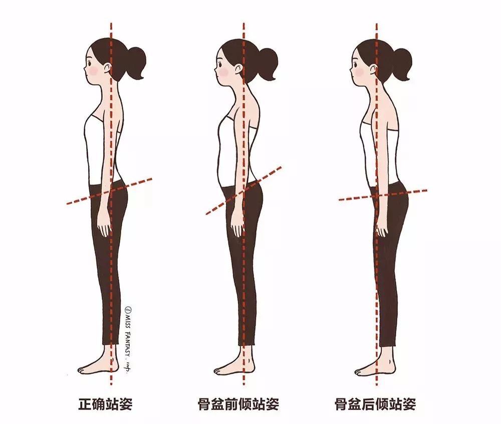 骨盆前后倾斜图片