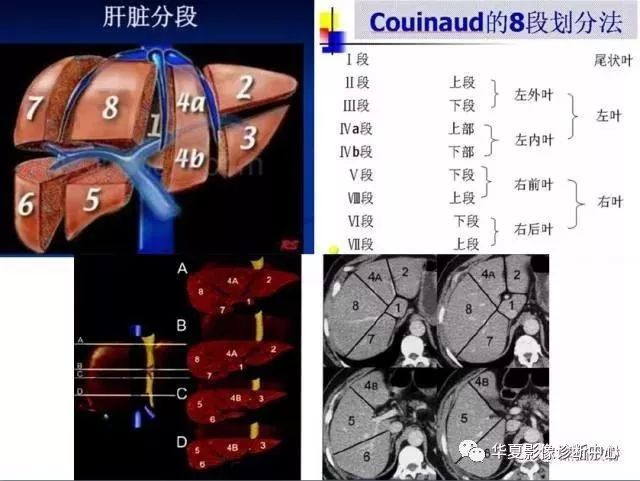 上腹部断层解剖第一层左上图中的阿拉伯数字提示"肝段"1,肝右叶;2,腹