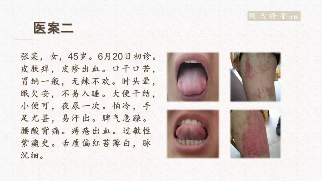 所以我们初看的话,这个似乎是一个厥阴病,我们在群里也常常遇到这种