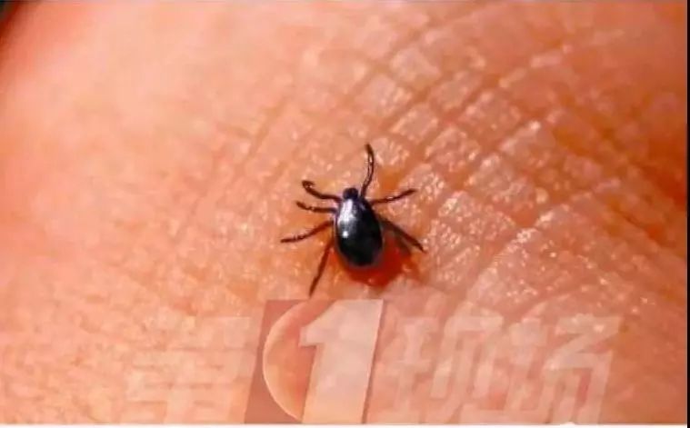 广东多名儿童被这种小虫咬伤,高烧10天未退,严重可致命!_恙虫