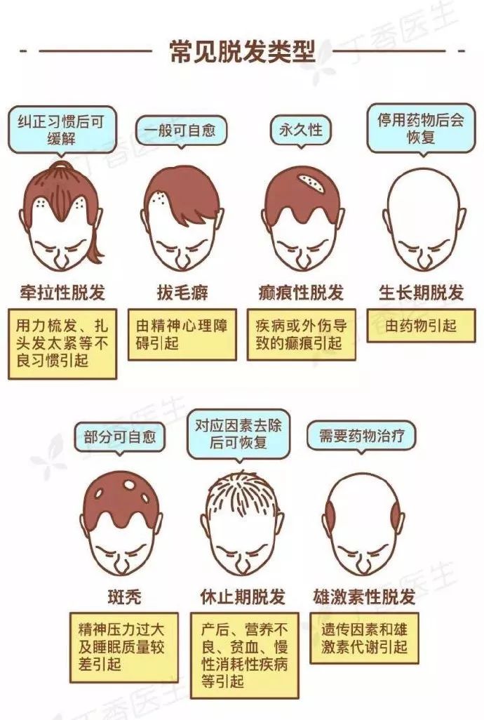 【健康】常见的脱发类型有 7 种,分别应该怎么治疗呢