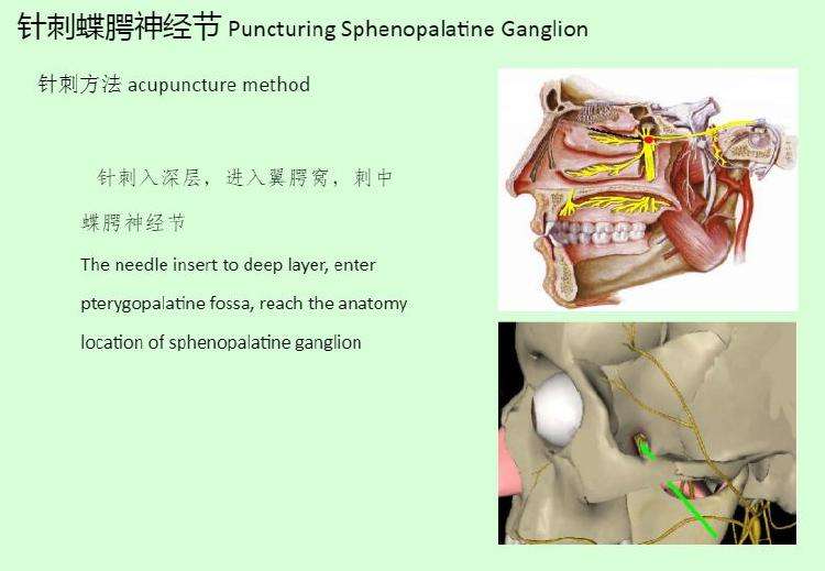 首大杨威新吾针灸治疗过敏性鼻炎