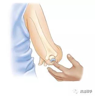 "矿工肘","扳机指","裁缝臀"......都是什么病?_摩擦