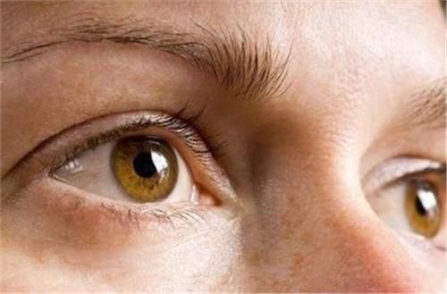 眼睛发黄是怎么回事?眼睛发黄的几大原因