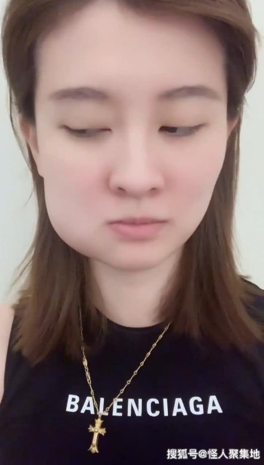 乔欣拔完智齿长了个大包成仓鼠女孩这位日本美少女更可爱