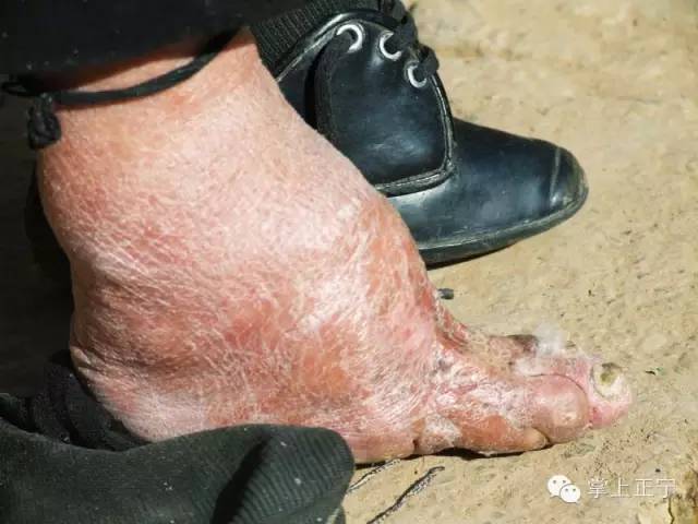 旧社会三寸金莲的苦情正宁有传世歌谣广为传送