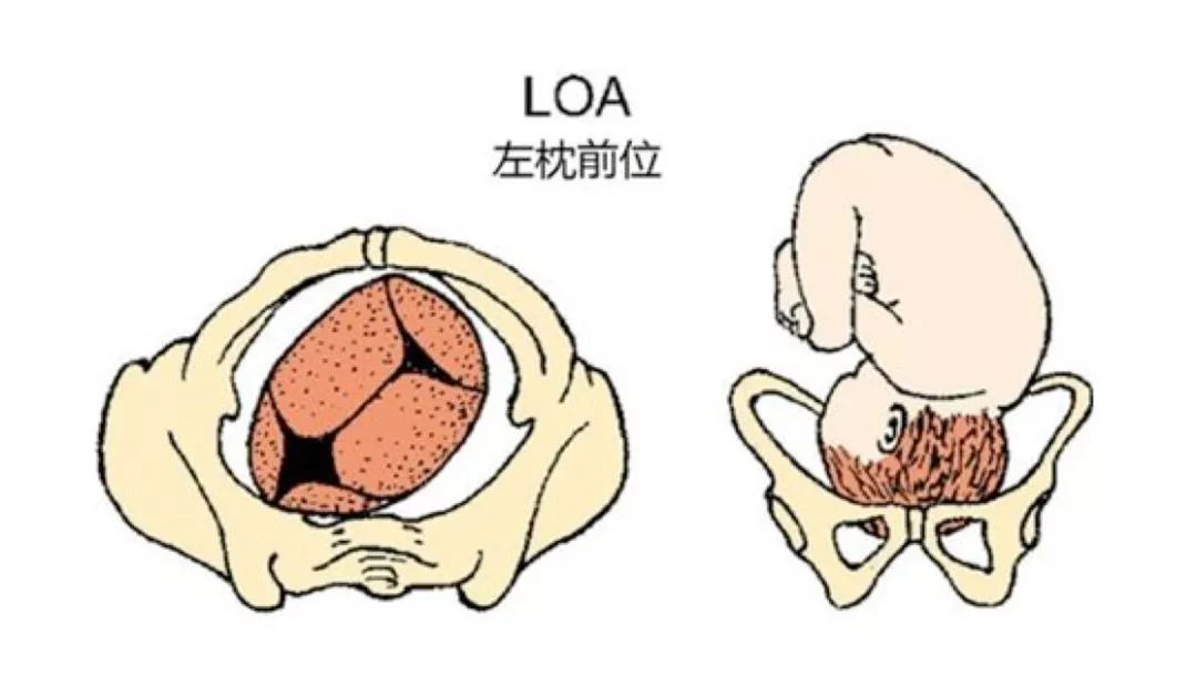 左枕前位胎儿图图片