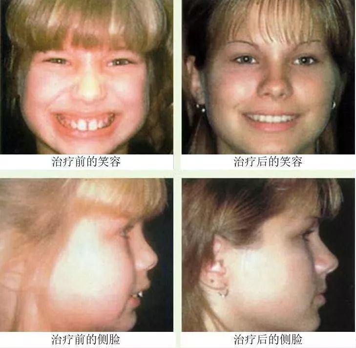 3岁前这些发育细节没注意宝宝可能会变丑