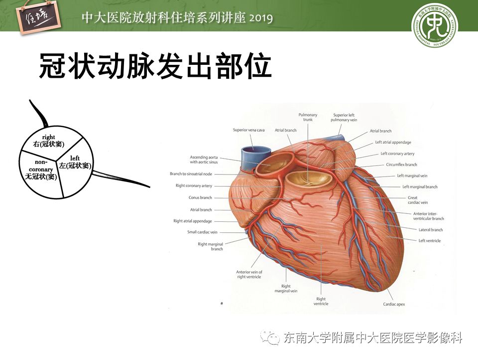 【中大放射住培系列講座 第76期】冠狀動脈cta診斷流程