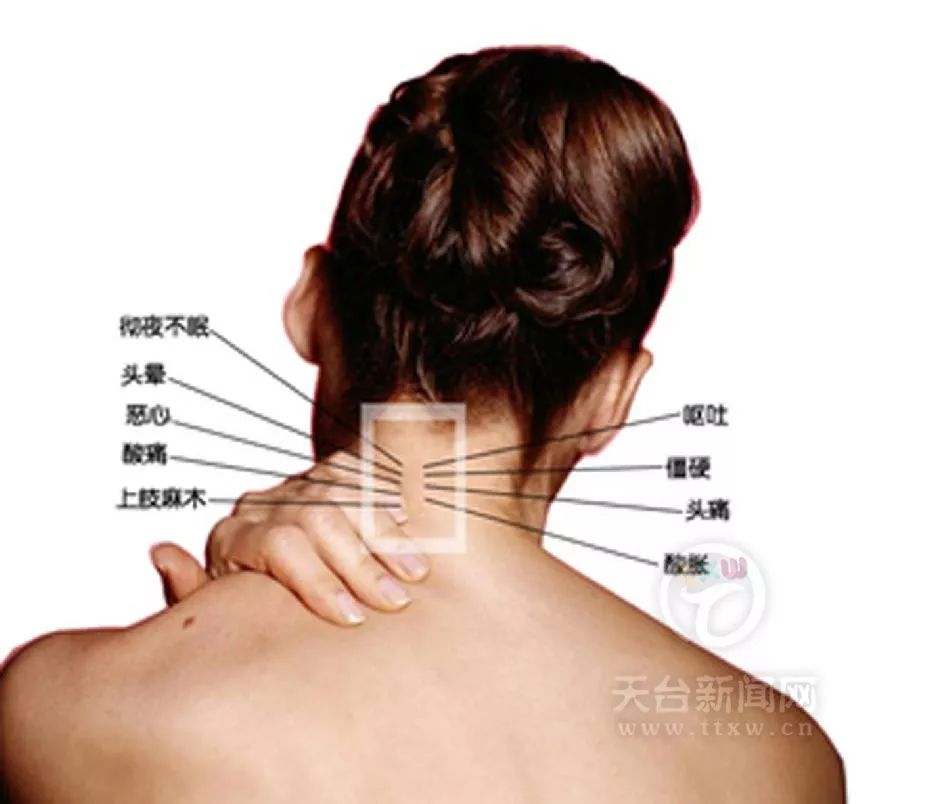 颈椎病至少可引发全身70种病症甚至猝死