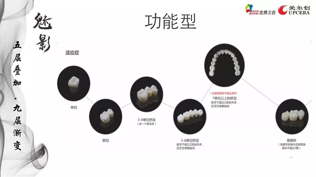 九月新品愛爾創魅影氧化鋯無飾瓷的前牙全冠修復產品