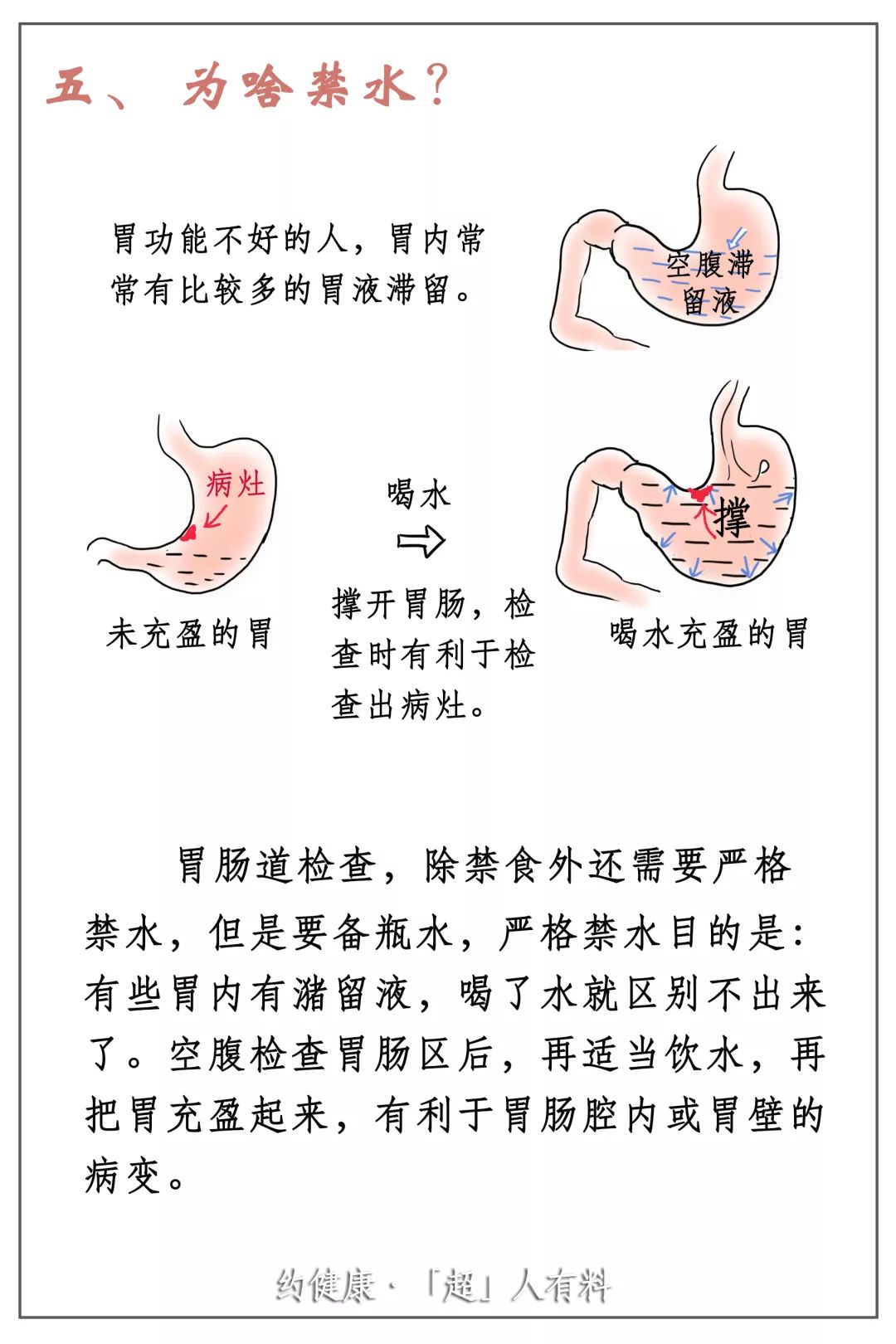 提醒體檢季來襲不是隻有抽血做胃鏡要空腹做超聲也要空腹