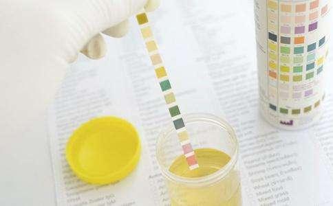 了解尿糖情况,更主要的是看是否有尿酮体,尿蛋白,以利于临床分型及