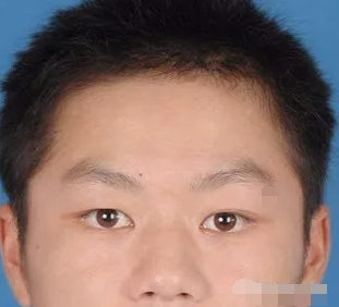 一生容易多灾多难的面相