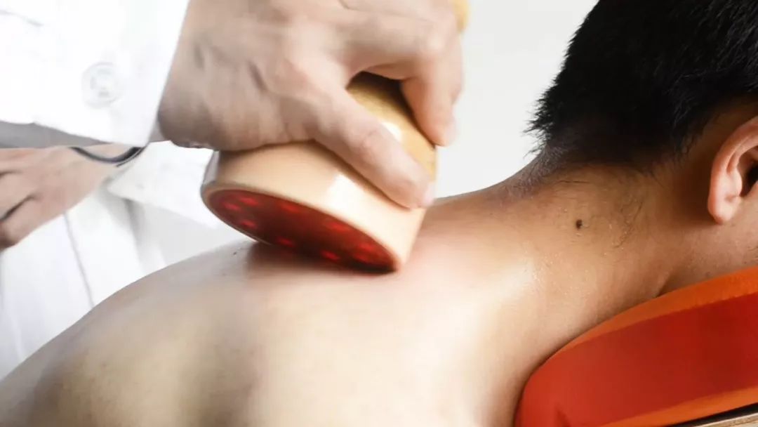 扶阳罐温通法联合电针治疗肩周炎的临床研究