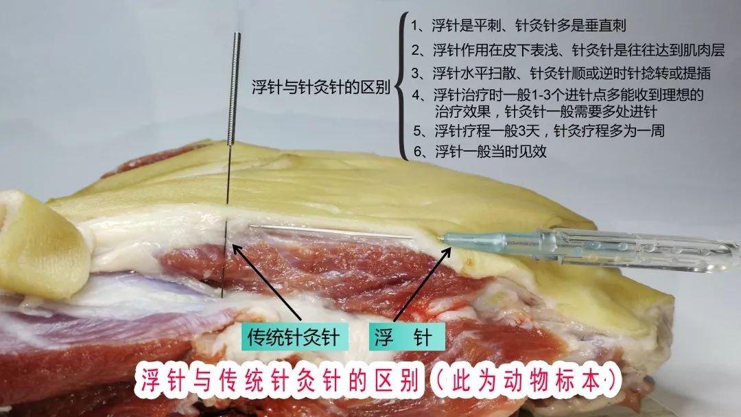 浮针安全如何证明证据在此奉送不谢