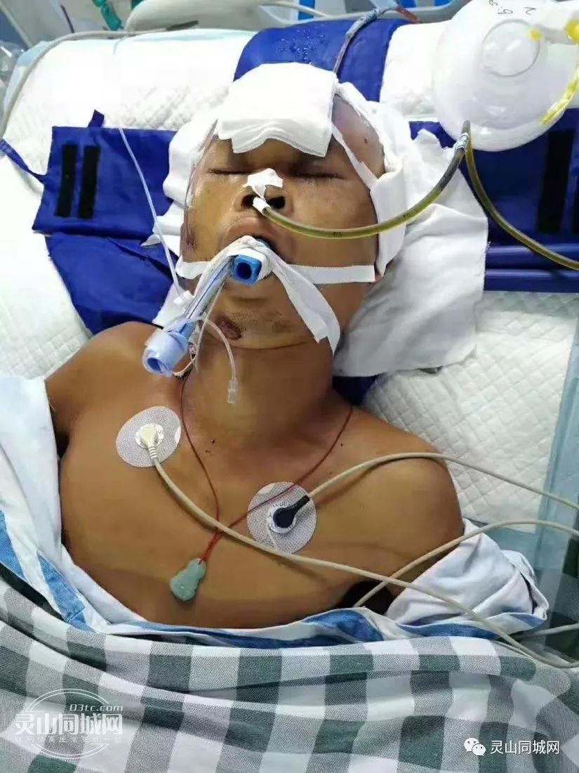 急寻家属灵山男子重伤躺路边现在灵山人民医院icu