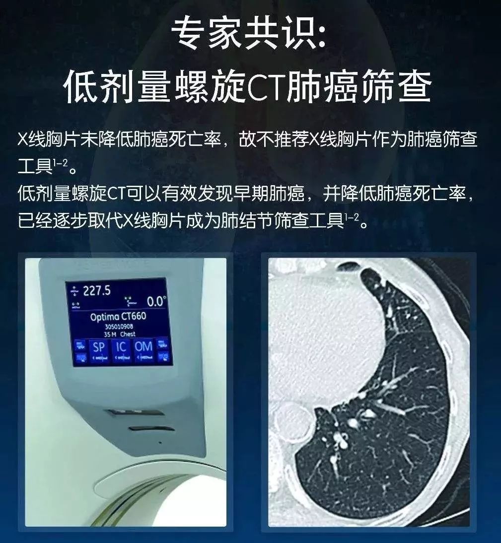 纪教授说医低剂量螺旋ct凭啥练就火眼金睛