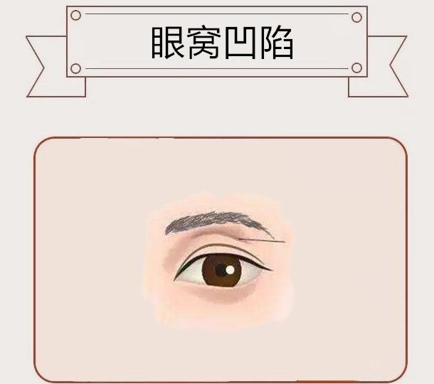 五种穷相晚年孤苦无依儿女不管白忙活一场