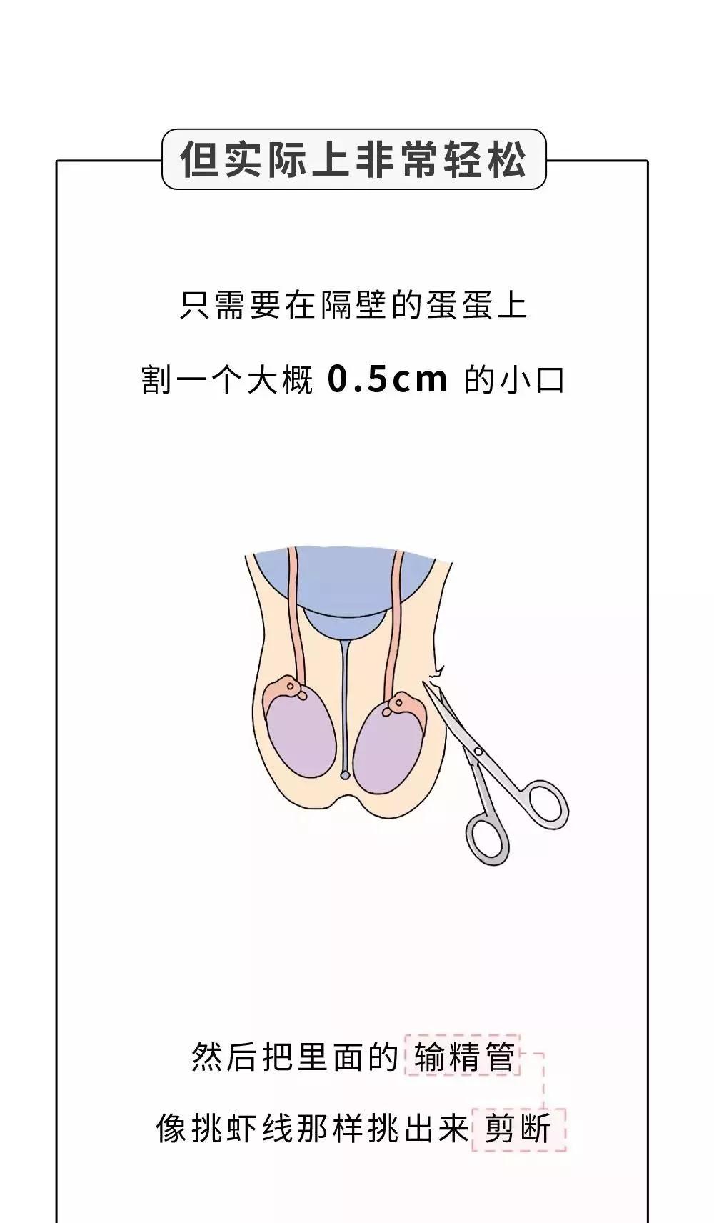 你不愿意为我结扎就是不爱我男生哭了