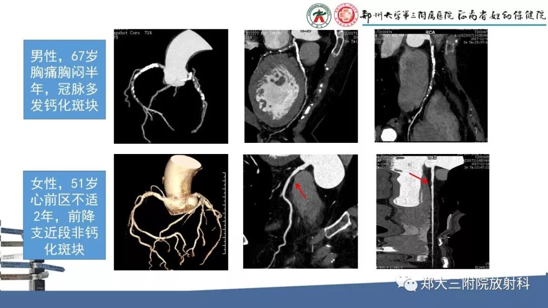 cta钻石(ctfau750钻戒系列)