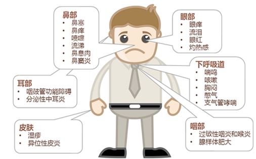 过敏性鼻炎都有什么症状和并发症?