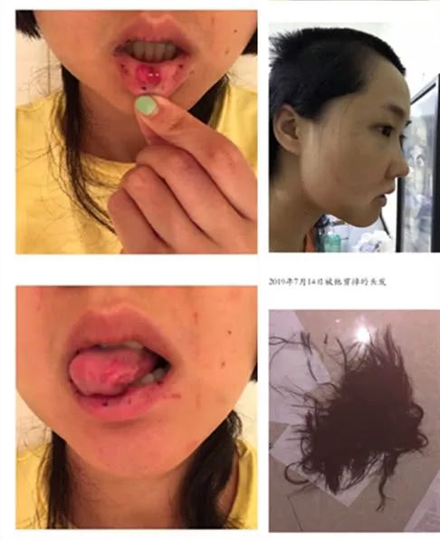 翻看张嫮目的微博,充斥着大量的戾气,还曾发文谩骂过张珂玄的前男友.