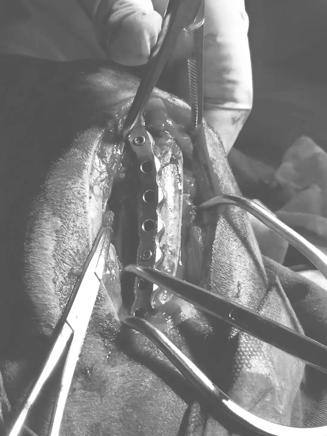【病例分享】金毛股骨远端粉碎性骨折,prcl锁定骨板系统临床病例分享.