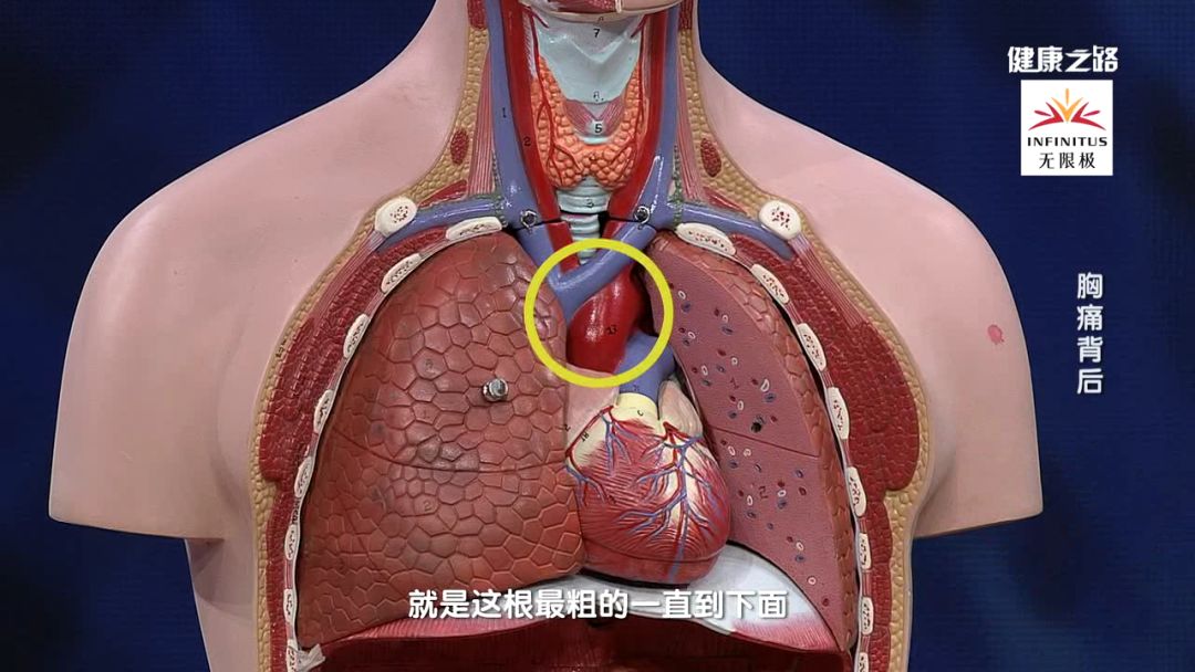 主动脉夹层发生原因