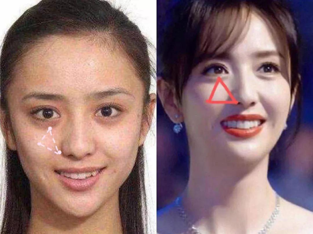 像赵丽颖这类,颧骨平且宽,三角形的面积则更大,且视觉上眼下的高度与