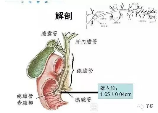 ercp插管反复进胰管后应对策略与反思附2例报道