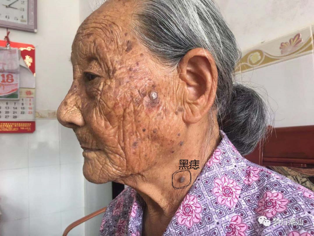 [寻家乡里湖]梅州五华93岁露三妹(谐音)奶奶寻根67_老人