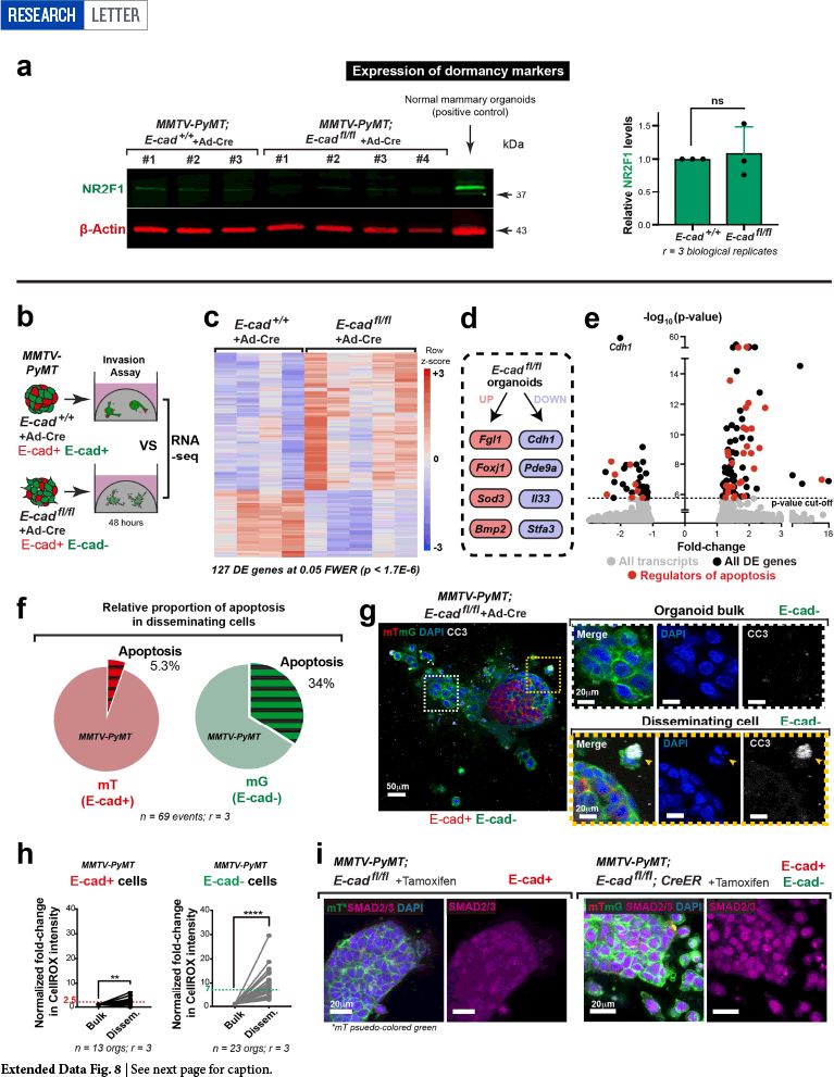 科学家破解乳腺癌转移必需的生存技能