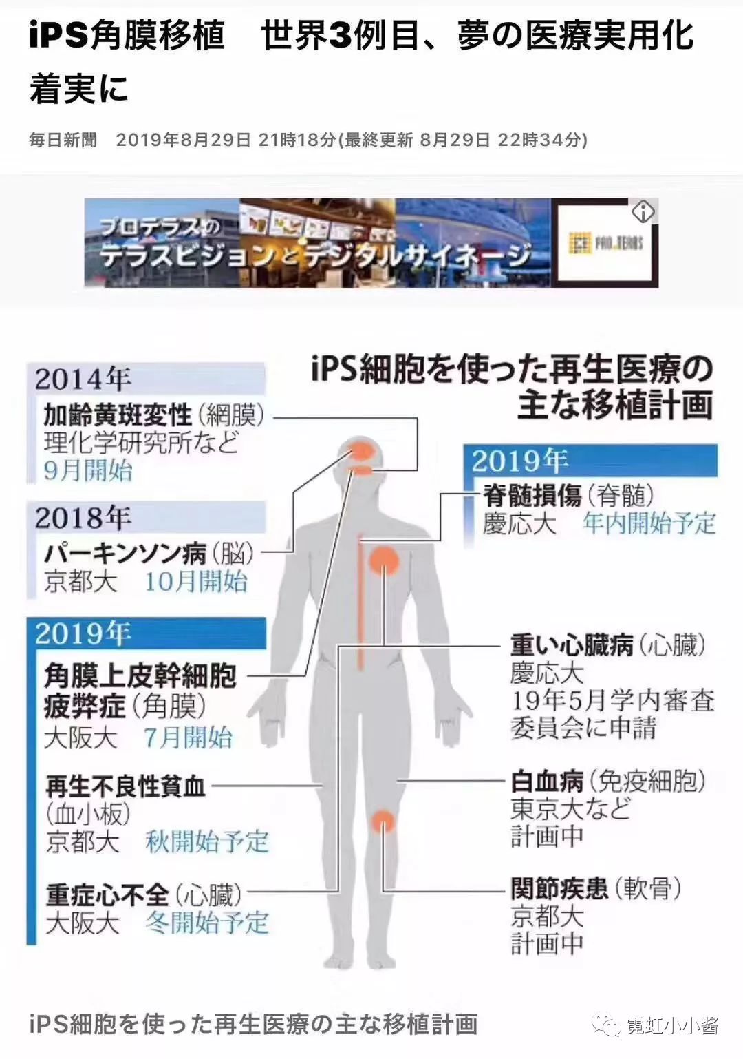 全球首例ips制成眼角膜移植成功 |日本医疗_干细胞