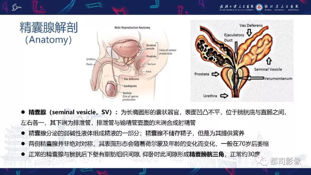 精囊腺病变mri表现