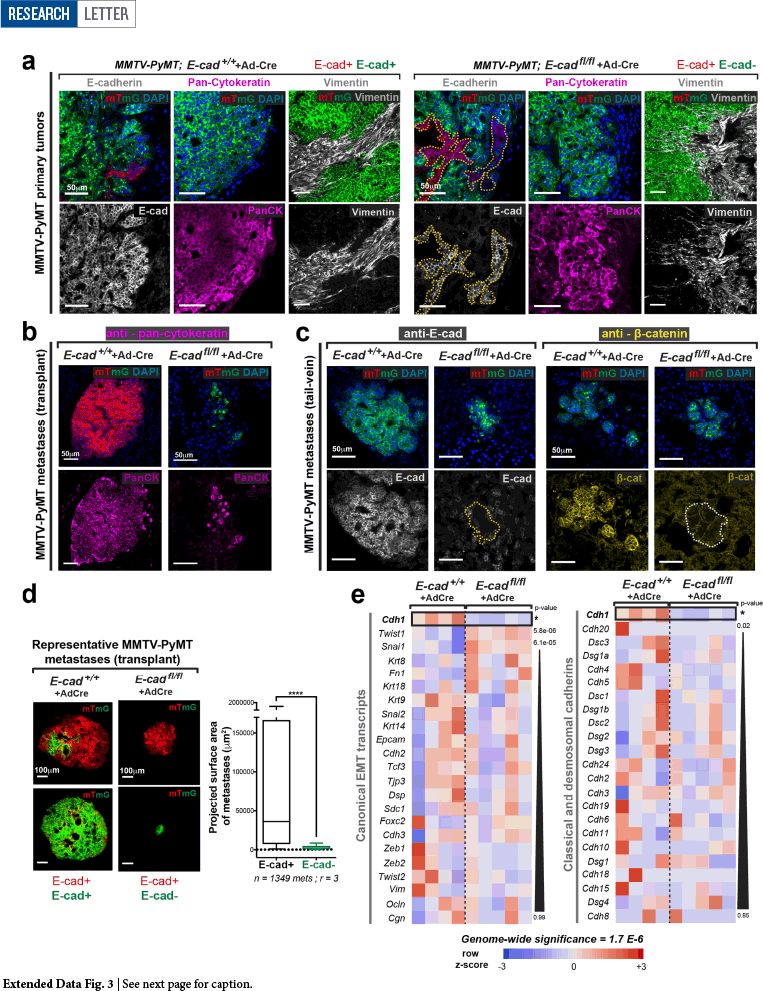 科学家破解乳腺癌转移必需的生存技能