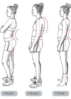 不正确的站姿图片