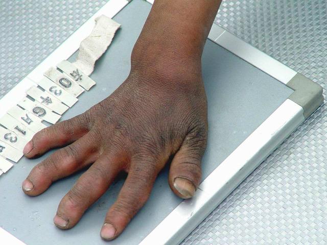 中国有超过一半的人缺硒,这里面有你吗?