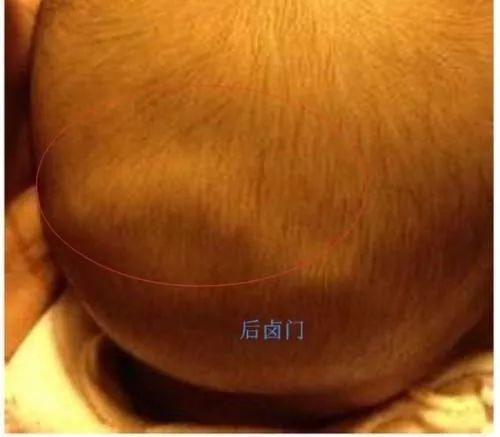 六个月宝宝方颅图片图片