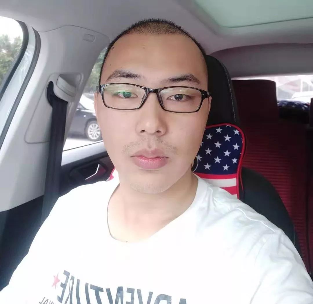 脱发对颜值影响有多大哈尔滨90后秃顶奶爸6小时长出头发帅给你看