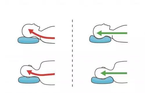 高低枕的正确枕法图片图片